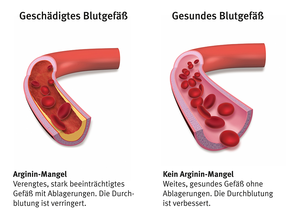 themenshop_bluthochdruck_bild2.jpg